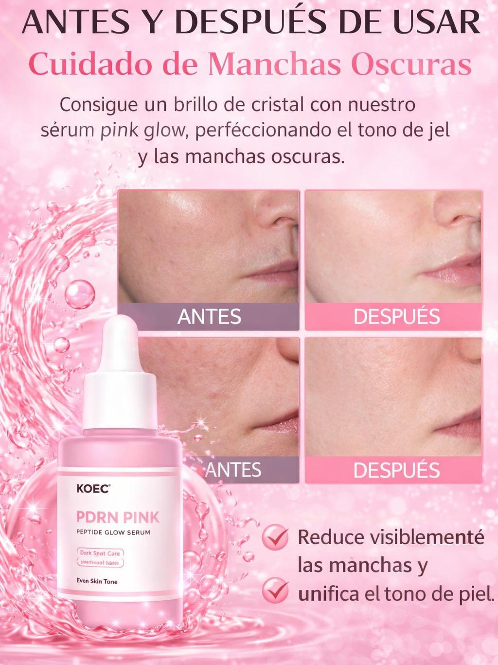 KOEC Rose PDRN-suero brillante con péptido rosa, suavizante reafirmante para la piel opaca, cuidado de las manchas oscuras, incluso el tono de la piel, mejora la elasticidad de la piel