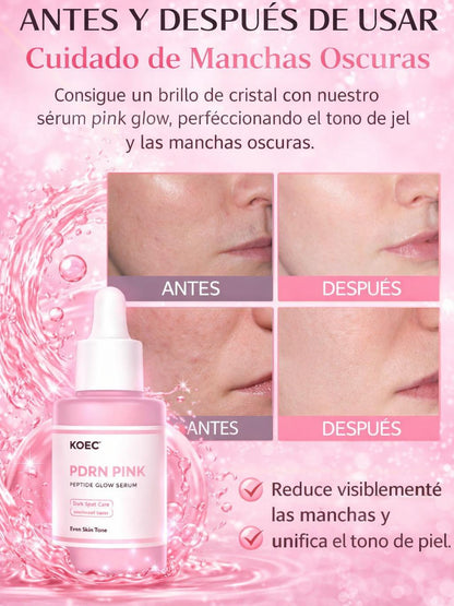 KOEC Rose PDRN-suero brillante con péptido rosa, suavizante reafirmante para la piel opaca, cuidado de las manchas oscuras, incluso el tono de la piel, mejora la elasticidad de la piel