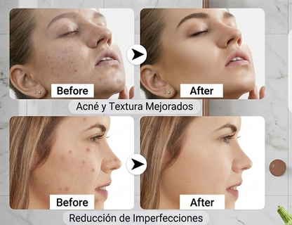 Stick Detox Facial Tratamiento para Acné y Puntos Negros con Extractos de berenjena