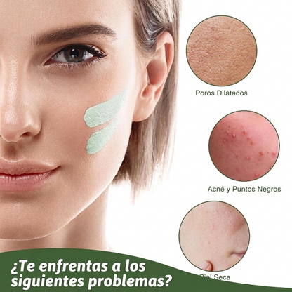 Stick Detox Facial 3 Unidades Tratamiento para Acné y Puntos Negros con Extractos de Té Verde y Berenjena