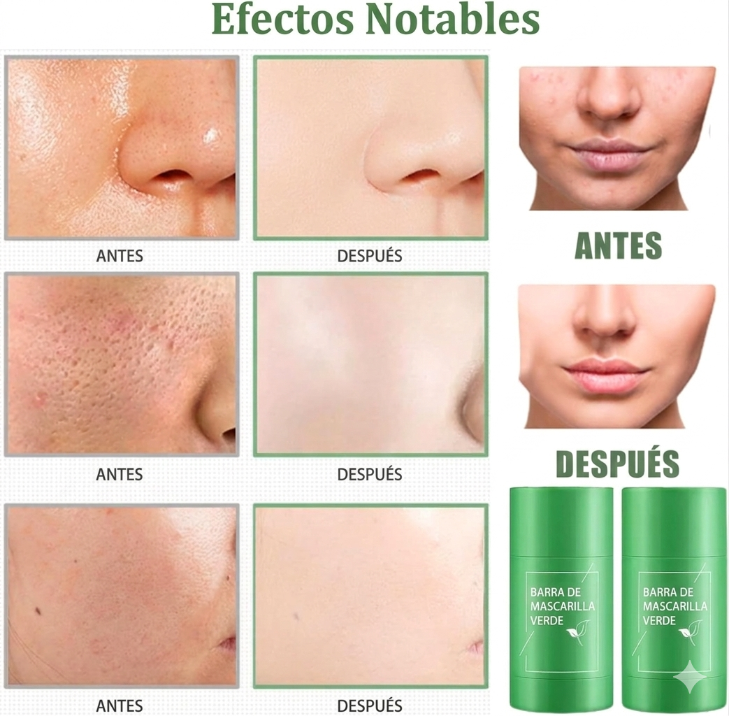 Stick Detox Facial 3 Unidades Tratamiento para Acné y Puntos Negros con Extractos de Té Verde y Berenjena