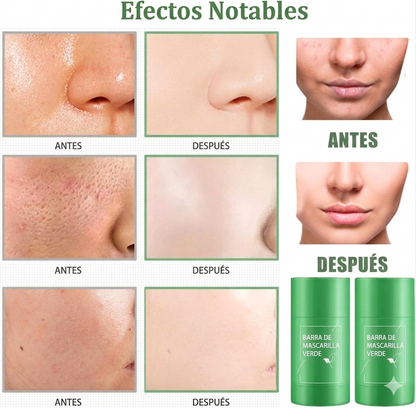 Stick Detox Facial 3 Unidades Tratamiento para Acné y Puntos Negros con Extractos de Té Verde y Berenjena