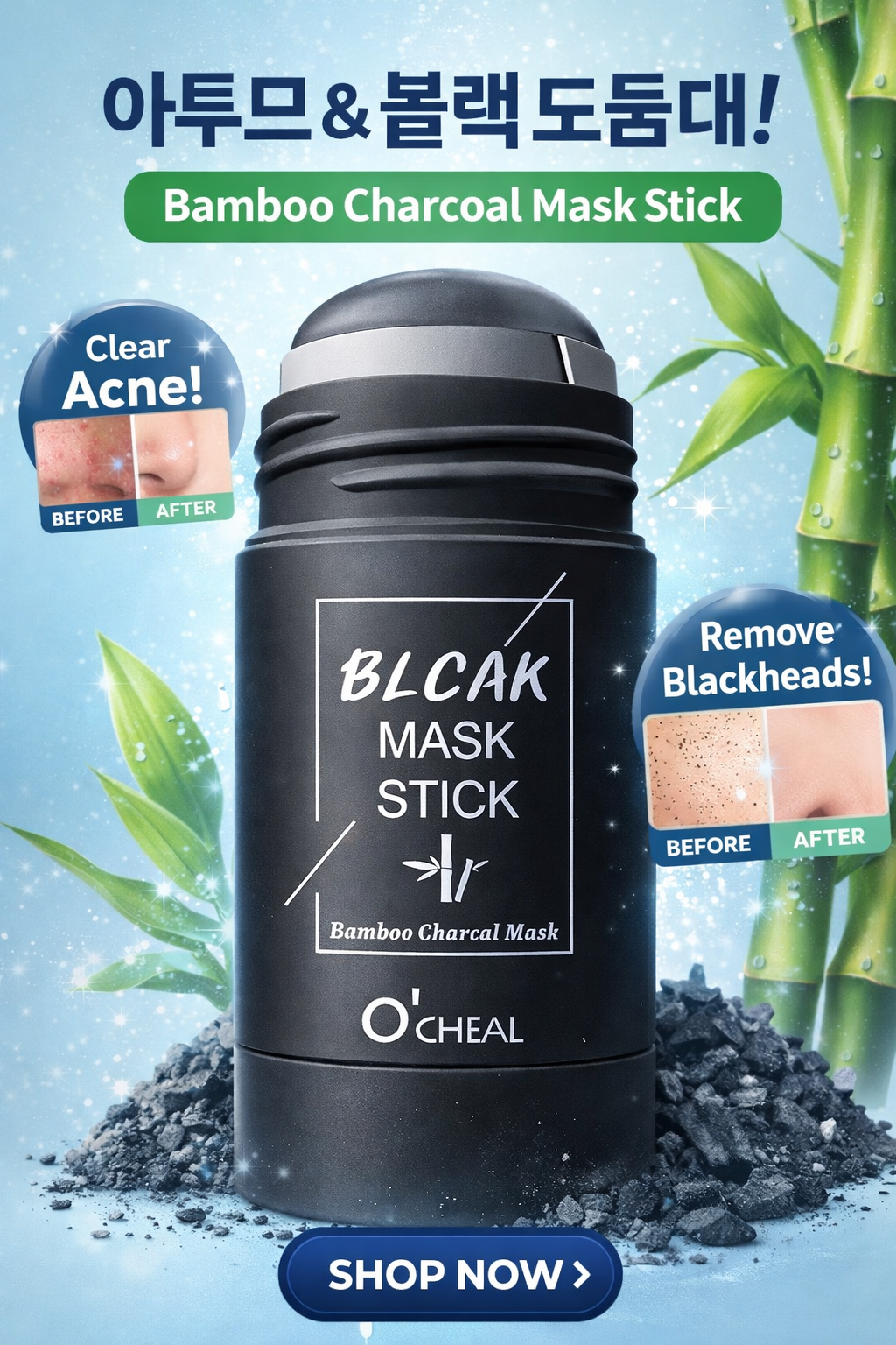 Stick Detox Facial Tratamiento para Acné y Puntos Negros con Carbón de bambú